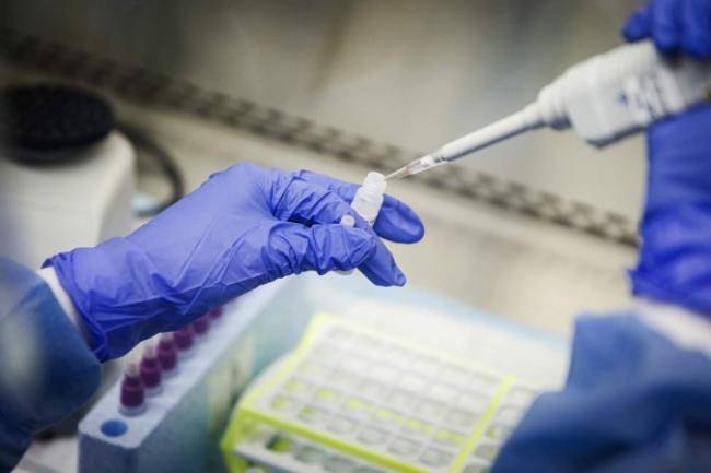 Gündəlik test sayının az olmasına səbəb nədir? -