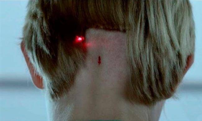 İnsanların çipləşməsinin qiyməti açıqlanıb -