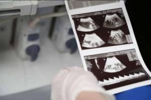 Bakıda &ouml;zəl klinikada bakirə qızı nişanlısının yanında... Xəbər şəkili