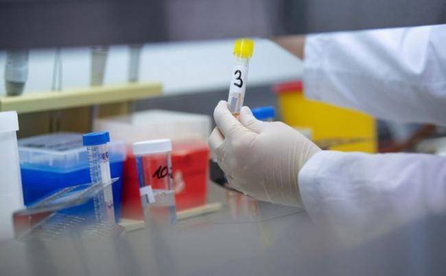 Qanda anticismin yoxlanılması üçün ölkəyə 10 minə yaxın test gətirilib