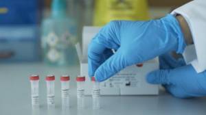 Azərbaycanda koronavirusla bağlı ümumi test sayı açıqlandı - STATİSTİKA Xəbər şəkili