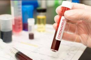 Koronavirus bu ölkələrdə ŞİDDƏTLƏ ARTIR: