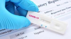 Koronavirus testinin cavabı gecikənlər nə etməlidir? Xəbər şəkili