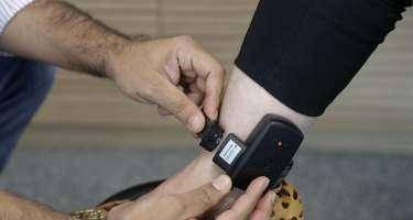 Elektron qolbağa görə həyatını itirdi