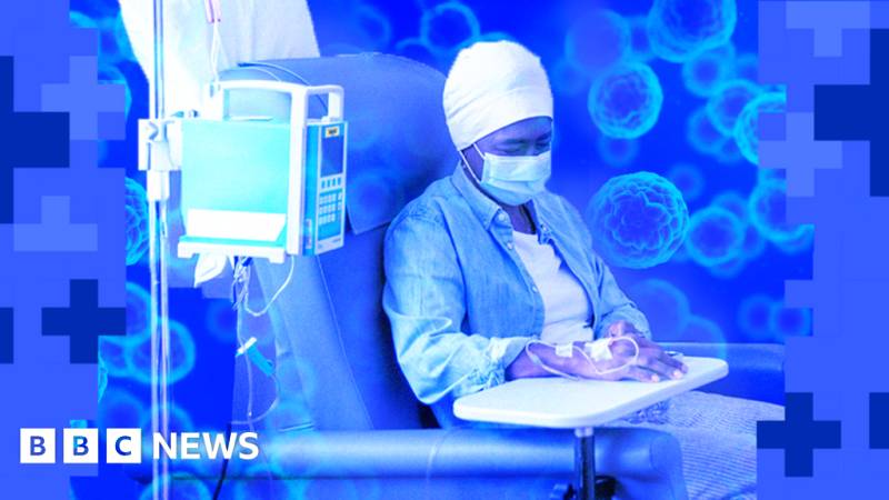 İngiltərədə Xərçəng Müalicəsində Dəhşətli Gecikmə: 121 Xəstəxanadan Yalnız 3-ü Hədəfə Çatır