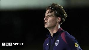 Alex Scott Serbiya ilə Oyuna Görə İngiltərənin Heyətindən Çıxarıldı