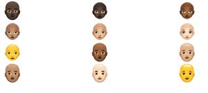 Süni İntellekt Saç Tökülməsini Diaqnoz Edir: "MyHair AI" Platforması Necə İşləyir? Xəbər şəkili