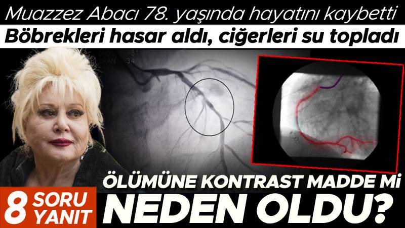 Muazzez Abacının ölümü ətrafında şübhələr: Böyrək zədəsi və ağciyərlərdə su yığılmasına kontrast maye səbəb oldumu?