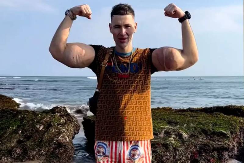 Rus "Temel Reis" Kirill Tereshinin Qolları İnfeksiya Səbəbindən Amputasiya Təhlükəsində Xəbər şəkili