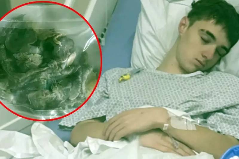 Elektron Siqaret Dəhşəti: Gəncin Ağciyəri Çökdü və Qismən Kəsilərək Çıxarıldı